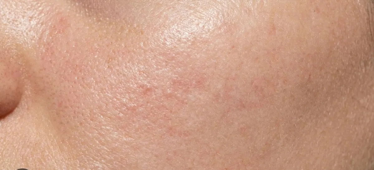 Close-up of combination skin texture