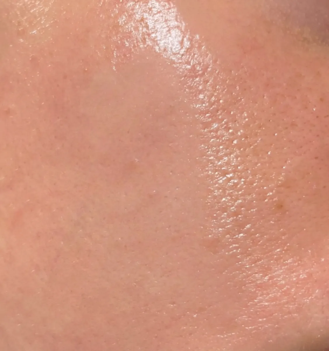 Close-up of oily skin with visible shine